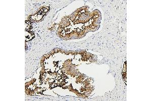 IHC analysis of RAB27A using anti-RAB27A antibody (ABIN7602714).