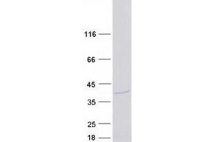 Western Blotting (WB) image for ATPase, H+ Transporting, Lysosomal 31kDa, V1 Subunit E1 (ATP6V1E1) (Transcript Variant 1) protein (Myc-DYKDDDDK Tag) (ABIN2715059)