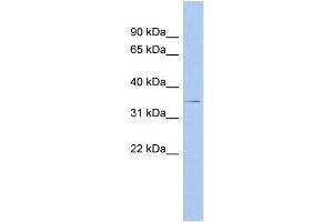 WB Suggested Anti-THPO Antibody Titration: 0.