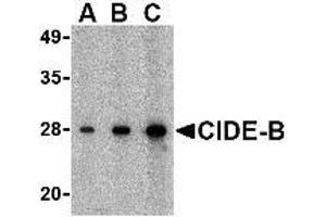 Western blot analysis of CIDE-B in mouse small intestine tissue lysate with AP30232PU-N CIDE-B antibody at (A) 0. (CIDEB Antikörper  (C-Term))