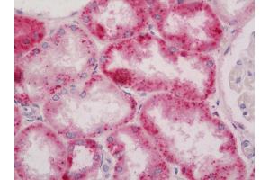 Immunohistochemistry (Paraffin-embedded Sections) (IHC (p)) image for anti-Ribonuclease, RNase A Family, 2 (Liver, Eosinophil-Derived Neurotoxin) (RNASE2) antibody (FITC) (ABIN2579177)