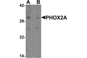 Western blot analysis of PHOX2A in rat brain tissue lysate with PHOX2A antibody at 1 ug/ml in (A) the absence and (B) the presence of blocking peptide.
