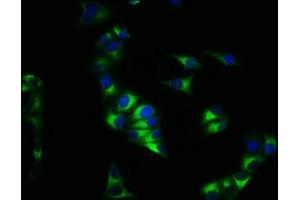 Immunofluorescence staining of Hela cells with ABIN7146107 at 1:200, counter-stained with DAPI. (CXCR4 Antikörper  (AA 1-356))