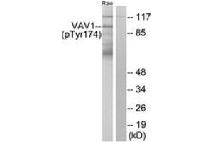 Western blot analysis of extracts from RAW264. (VAV1 Antikörper  (pTyr174))