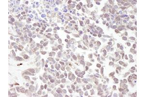 Immunohistochemistry (IHC) image for anti-Metastasis Associated 1 (MTA1) (AA 400-450) antibody (ABIN7448676)