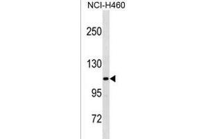 THBS4 Antibody (C-term) (ABIN1881882 and ABIN2838744) western blot analysis in NCI- cell line lysates (35 μg/lane). (THBS4 Antikörper  (C-Term))