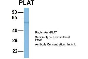 Host: Rabbit  Target Name: PLAT  Sample Tissue: Human Fetal Heart  Antibody Dilution: 1.