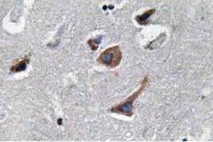 Immunohistochemistry (IHC) analyzes of IL-12A antibody in paraffin-embedded human brain tissue. (IL12A Antikörper)