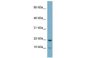 D15WSU75E antibody used at 1 ug/ml to detect target protein. (DESI1 Antikörper  (Middle Region))