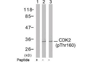 Image no. 2 for anti-Cyclin-Dependent Kinase 2 (CDK2) (pThr160) antibody (ABIN196844) (CDK2 Antikörper  (pThr160))