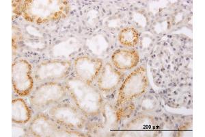 Immunoperoxidase of monoclonal antibody to PHACS on formalin-fixed paraffin-embedded human kidney. (PHACS Antikörper  (AA 1-100))