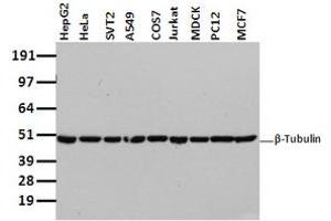Image no. 2 for anti-Tubulin beta 4a (TUBB4A) antibody (ABIN1501580)