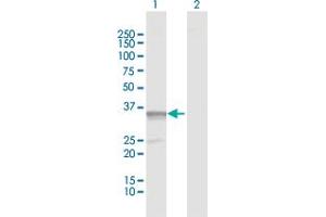 Western Blot analysis of PDXK expression in transfected 293T cell line by PDXK MaxPab polyclonal antibody. (PDXK Antikörper  (AA 1-312))