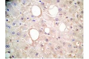 Immunohistochemistry (IHC) image for anti-Fibroblast Growth Factor 21 (FGF21) (AA 26-47) antibody (ABIN2872208)