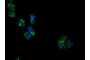 Anti-PECR mouse monoclonal antibody (ABIN2453444) immunofluorescent staining of COS7 cells transiently transfected by pCMV6-ENTRY PECR (RC200822). (PECR Antikörper)