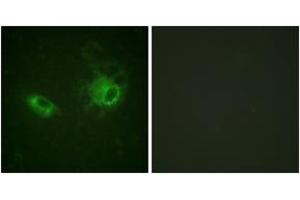 Immunofluorescence analysis of HeLa cells, using PDGFRB (Ab-1009) Antibody.