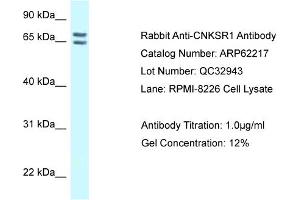 Western Blotting (WB) image for anti-Connector Enhancer of Kinase Suppressor of Ras 1 (CNKSR1) (C-Term) antibody (ABIN2789066) (CNKSR1 Antikörper  (C-Term))