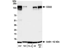 Western Blotting (WB) image for anti-CD22 Molecule (CD22) (AA 750-800) antibody (ABIN7795736)