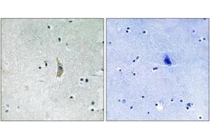 Immunohistochemistry analysis of paraffin-embedded human brain tissue, using PSEN1 (Ab-357) Antibody. (Presenilin 1 Antikörper  (AA 323-372))