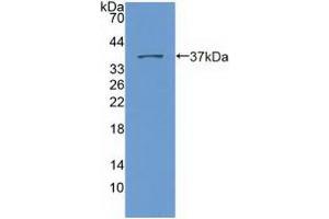 Western blot analysis of recombinant Human Nesp2. (SYNE2 Antikörper  (AA 6-296))