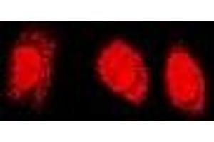 Immunofluorescent analysis of PSMC4 staining in U2OS cells.