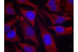 Immunofluorescence staining of methanol-fixed Hela cells using synapsin(Phospho-Ser9) Antibody. (SYN1 Antikörper  (pSer9))