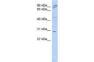 WB Suggested Anti-HAX1 Antibody Titration: 0. (HAX1 Antikörper  (Middle Region))