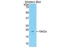 Western Blotting (WB) image for anti-Mannose Associated Serine Protease 2 (AA 280-433) antibody (ABIN1859764) (Mannose Associated Serine Protease 2 (AA 280-433) Antikörper)