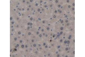 IHC-P analysis of Rat Tissue, with DAB staining. (CD11b Antikörper  (AA 31-160))