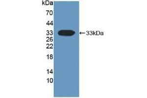 Detection of Recombinant DKK1, Human using Monoclonal Antibody to Dickkopf Related Protein 1 (DKK1) (DKK1 Antikörper  (AA 33-266))