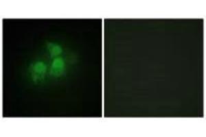 Immunofluorescence analysis of HepG2 cells, using IPPK antibody. (IPPK Antikörper)