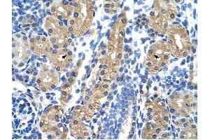 HSD17B1 antibody was used for immunohistochemistry at a concentration of 4-8 ug/ml to stain Epithelial cells of renal tubule (arrows) in Human Kidney. (HSD17B1 Antikörper)