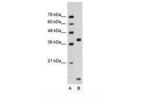 Image no. 1 for anti-FXYD Domain Containing Ion Transport Regulator 5 (FXYD5) (AA 66-115) antibody (ABIN203357)
