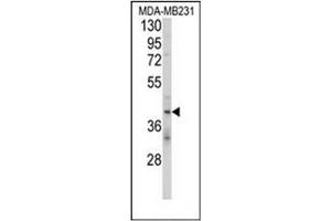 Western blot analysis of CD158d / KIR2DL4 Antibody (C-term) in MDA-MB231 cell line lysates (35ug/lane). (KIR2DL4/CD158d Antikörper  (C-Term))
