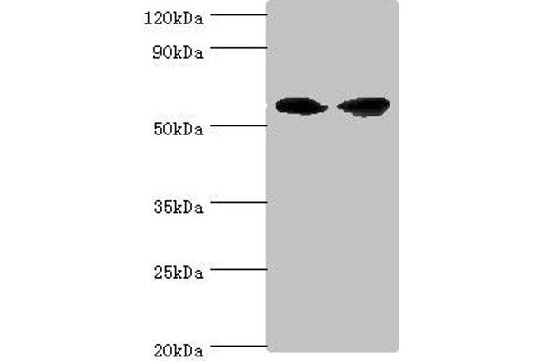 AHCYL1 Antikörper  (AA 31-260)