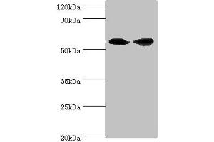 Western blot All lanes: AHCYL1 antibody at 12 μg/mL Lane 1: Hela whole cell lysate Lane 2: 293T whole cell lysate Secondary Goat polyclonal to rabbit IgG at 1/10000 dilution Predicted band size: 59, 54 kDa Observed band size: 59 kDa (AHCYL1 Antikörper  (AA 31-260))
