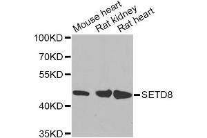 Western blot analysis of extracts of various cell lines, using SETD8 Antibody (ABIN5974407) at 1/1000 dilution. (SETD8 Antikörper)