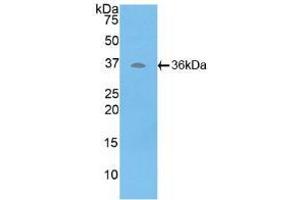Western blot analysis of recombinant Human ATP6AP2. (ATP6AP2 Antikörper  (AA 17-302))