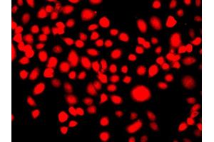 Immunofluorescence analysis of A549 cells using IFRD1 antibody. (IFRD1 Antikörper)
