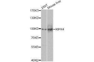 Western blot analysis of extracts of various cell lines, using RIPK4 antibody. (RIPK4 Antikörper  (AA 240-520))