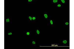 Immunofluorescence of monoclonal antibody to HNRNPG-T on HeLa cell. (RBMXL2 Antikörper  (AA 1-90))