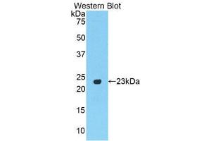 Western Blotting (WB) image for anti-Peroxisome Proliferator-Activated Receptor gamma (PPARG) (AA 311-493) antibody (ABIN3207603) (PPARG Antikörper  (AA 311-493))