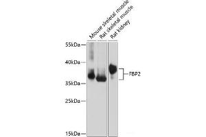 Western blot analysis of extracts of various cell lines using FBP2 Polyclonal Antibody at dilution of 1:1000. (FBP2 Antikörper)