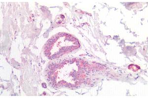 Detection of CSN2 in Human Breast Tissue using Polyclonal Antibody to Casein Beta (CSN2) (CSN2 Antikörper  (AA 41-198))