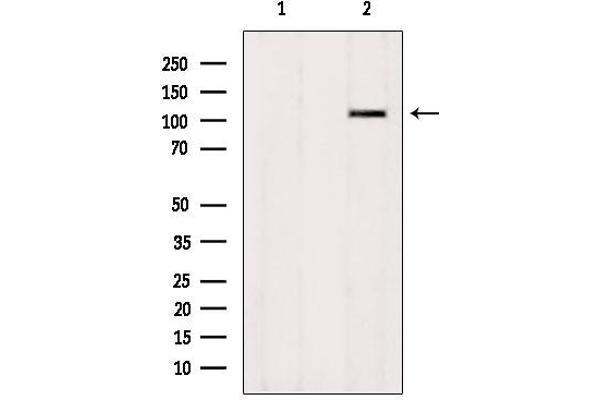 ZNF295 Antikörper  (N-Term)