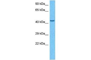 Host:  Rabbit  Target Name:  KCNJ6  Sample Type:  MCF7 Whole Cell lysates  Antibody Dilution:  1.