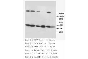 Image no. 2 for anti-Fas Ligand (TNF Superfamily, Member 6) (FASL) (C-Term) antibody (ABIN1492926) (FASL Antikörper  (C-Term))