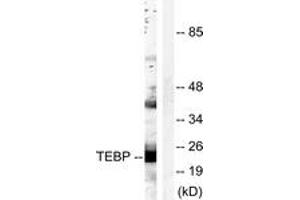Western blot analysis of extracts from NIH-3T3 cells, treated with EGF 200ng/ml 30', using TEBP (Ab-113) Antibody. (NKX2-1 Antikörper  (AA 79-128))