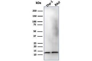 Western Blot Analysis of THP-1 and Raji Cell lysate using Beta-2-Microglobulin Mouse Monoclonal Antibody (B2M/1118). (beta-2 Microglobulin Antikörper)