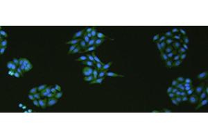 Immunofluorescence analysIs of HepG2 cell using SLC18A3 Polyclonal Antibody at dilution of 1:50 (SLC18A3 Antikörper)
